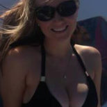 Actual patient of Dr Turowski - Breast augmentation