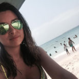 Actual patient of Dr Turowski - Breast augmentation