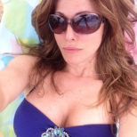 Actual patient of Dr Turowski - Breast augmentation